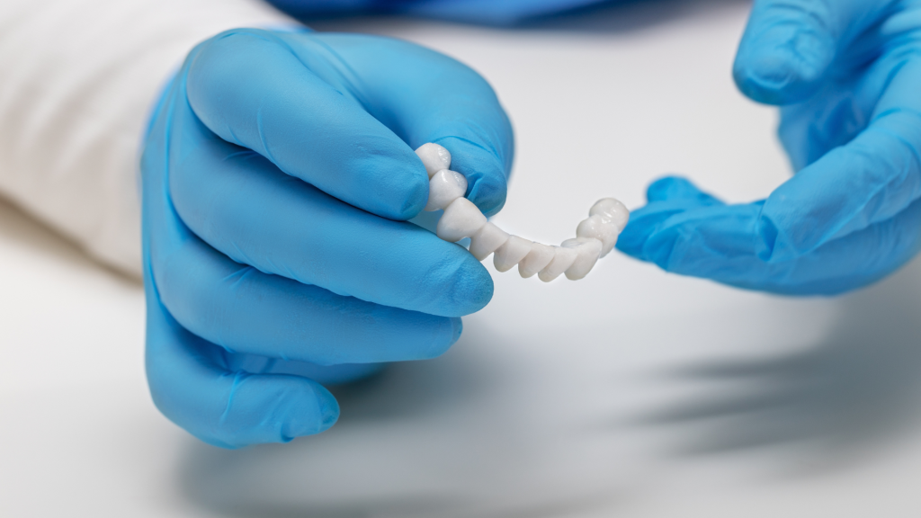 Dental bridges
